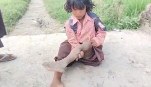 एक पैर पर कूदकर स्कूल जाती हैं 7 साल की रागिनी, अब बलिया DM से की भावुक अपील! वायरल हो गई वीडियो